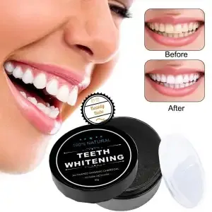 teeth whitening price in nepal
